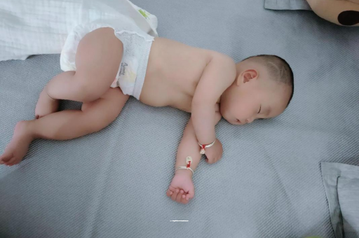 靖边六个月宝宝眼睛散光